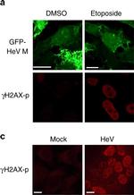 Rabbit IgG (H+L) Highly Cross-Adsorbed Secondary Antibody in Immunocytochemistry (ICC/IF)