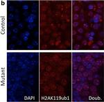 Rabbit IgG (H+L) Cross-Adsorbed Secondary Antibody in Immunohistochemistry (Paraffin) (IHC (P))