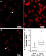 Rabbit IgG (H+L) Cross-Adsorbed Secondary Antibody in Immunohistochemistry (IHC)