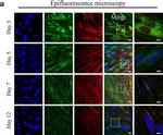 Rabbit IgG (H+L) Cross-Adsorbed Secondary Antibody in Immunohistochemistry (IHC)