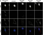 Rabbit IgG (H+L) Cross-Adsorbed Secondary Antibody in Immunocytochemistry (ICC/IF)