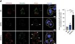 Mouse IgG (H+L) Highly Cross-Adsorbed Secondary Antibody in Immunocytochemistry (ICC/IF)