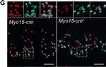 Rabbit IgG (H+L) Highly Cross-Adsorbed Secondary Antibody in Immunohistochemistry (IHC)