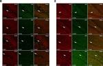 Rabbit IgG (H+L) Highly Cross-Adsorbed Secondary Antibody in Immunohistochemistry (IHC)