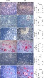 FOXP3 Antibody in Immunohistochemistry (IHC)