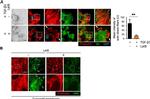 Mouse IgG (H+L) Highly Cross-Adsorbed Secondary Antibody in Immunocytochemistry (ICC/IF)