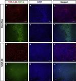 Mouse IgG (H+L) Highly Cross-Adsorbed Secondary Antibody in Immunocytochemistry (ICC/IF)