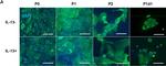 Mouse IgG (H+L) Highly Cross-Adsorbed Secondary Antibody in Immunocytochemistry (ICC/IF)