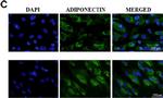 Mouse IgG (H+L) Highly Cross-Adsorbed Secondary Antibody in Immunocytochemistry (ICC/IF)