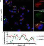 Rabbit IgG (H+L) Highly Cross-Adsorbed Secondary Antibody in Immunocytochemistry (ICC/IF)