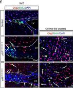 Rabbit IgG (H+L) Highly Cross-Adsorbed Secondary Antibody in Immunohistochemistry (Paraffin) (IHC (P))