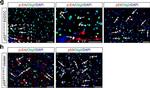 Rabbit IgG (H+L) Highly Cross-Adsorbed Secondary Antibody in Immunohistochemistry (IHC)