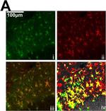 Chicken IgY (H+L) Secondary Antibody in Immunocytochemistry (ICC/IF)