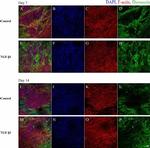 Rabbit IgG (H+L) Highly Cross-Adsorbed Secondary Antibody in Immunocytochemistry (ICC/IF)