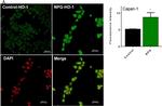 Rabbit IgG (H+L) Highly Cross-Adsorbed Secondary Antibody in Immunocytochemistry (ICC/IF)