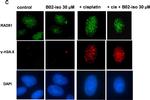 Rabbit IgG (H+L) Highly Cross-Adsorbed Secondary Antibody in Immunocytochemistry (ICC/IF)