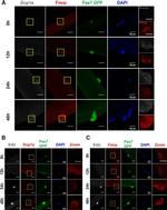 Rabbit IgG (H+L) Highly Cross-Adsorbed Secondary Antibody in Immunocytochemistry (ICC/IF)