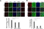 Rabbit IgG (H+L) Highly Cross-Adsorbed Secondary Antibody in Immunocytochemistry (ICC/IF)