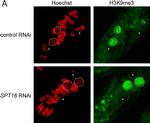 Rabbit IgG (H+L) Highly Cross-Adsorbed Secondary Antibody in Immunocytochemistry (ICC/IF)