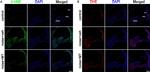 Rabbit IgG (H+L) Highly Cross-Adsorbed Secondary Antibody in Immunohistochemistry (IHC)