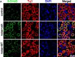 Rabbit IgG (H+L) Highly Cross-Adsorbed Secondary Antibody in Immunohistochemistry (IHC)