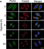 Rabbit IgG (H+L) Highly Cross-Adsorbed Secondary Antibody in Immunocytochemistry (ICC/IF)