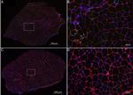 Rabbit IgG (H+L) Highly Cross-Adsorbed Secondary Antibody in Immunohistochemistry (IHC)