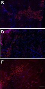 Rabbit IgG (H+L) Highly Cross-Adsorbed Secondary Antibody in Immunohistochemistry (IHC)