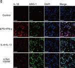 Rabbit IgG (H+L) Highly Cross-Adsorbed Secondary Antibody in Immunocytochemistry (ICC/IF)