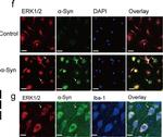 Rabbit IgG (H+L) Highly Cross-Adsorbed Secondary Antibody in Immunocytochemistry (ICC/IF)