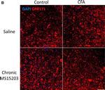 Rabbit IgG (H+L) Highly Cross-Adsorbed Secondary Antibody in Immunohistochemistry (IHC)