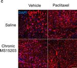 Rabbit IgG (H+L) Highly Cross-Adsorbed Secondary Antibody in Immunohistochemistry (IHC)