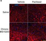 Rabbit IgG (H+L) Highly Cross-Adsorbed Secondary Antibody in Immunohistochemistry (IHC)