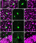 Chicken IgY (H+L) Secondary Antibody in Immunohistochemistry (IHC)