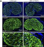 Rabbit IgG (H+L) Cross-Adsorbed Secondary Antibody in Immunohistochemistry (IHC)