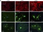 Rabbit IgG (H+L) Highly Cross-Adsorbed Secondary Antibody in Immunocytochemistry (ICC/IF)