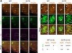 Rabbit IgG (H+L) Highly Cross-Adsorbed Secondary Antibody in Immunohistochemistry (PFA fixed) (IHC (PFA))