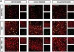 Rabbit IgG (H+L) Cross-Adsorbed Secondary Antibody in Immunohistochemistry (IHC)