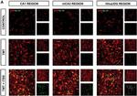 Rabbit IgG (H+L) Cross-Adsorbed Secondary Antibody in Immunohistochemistry (IHC)