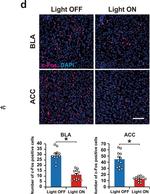 Rabbit IgG (H+L) Highly Cross-Adsorbed Secondary Antibody in Immunohistochemistry (IHC)