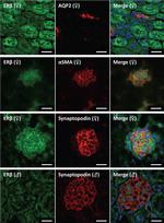 Goat IgG (H+L) Cross-Adsorbed Secondary Antibody in Immunohistochemistry (Frozen) (IHC (F))