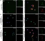 Mouse IgG (H+L) Cross-Adsorbed Secondary Antibody in Immunocytochemistry (ICC/IF)