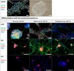 Goat IgG (H+L) Cross-Adsorbed Secondary Antibody in Immunocytochemistry (ICC/IF)