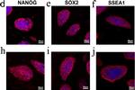 Mouse IgM (Heavy chain) Cross-Adsorbed Secondary Antibody in Immunocytochemistry (ICC/IF)