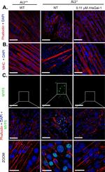 Mouse IgG (H+L) Highly Cross-Adsorbed Secondary Antibody in Immunocytochemistry (ICC/IF)