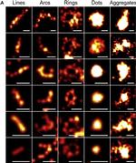 Rabbit IgG (H+L) Cross-Adsorbed Secondary Antibody in Immunocytochemistry (ICC/IF)