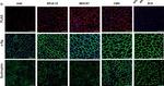 Rabbit IgG (H+L) Cross-Adsorbed Secondary Antibody in Immunohistochemistry (IHC)