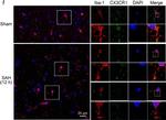 Goat IgG (H+L) Cross-Adsorbed Secondary Antibody in Immunohistochemistry (IHC)