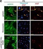 Mouse IgG (H+L) Highly Cross-Adsorbed Secondary Antibody in Immunocytochemistry (ICC/IF)