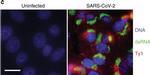 Mouse IgG (H+L) Highly Cross-Adsorbed Secondary Antibody in Immunocytochemistry (ICC/IF)